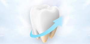teeth whitening