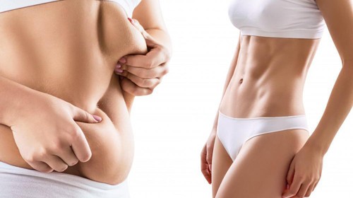 Diode-Laser-Lipolysis-slimming-–-A-Unique-Approach-to-Fat-Burning-and-Weight-Loss