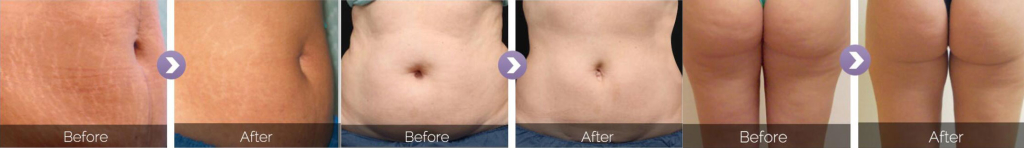iShape-1