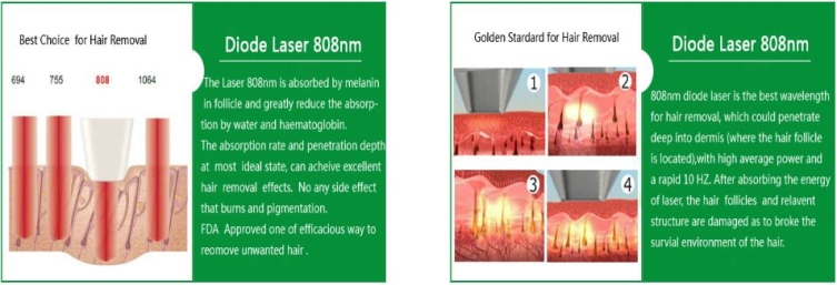 Diode Laser Working principle