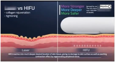 HIFU-Q6