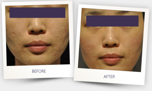 Courtesy of Choi Jun, MD, PhD, MayLin Clinic, Seoul, Korea