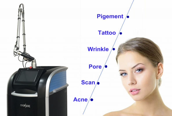 Laser IV