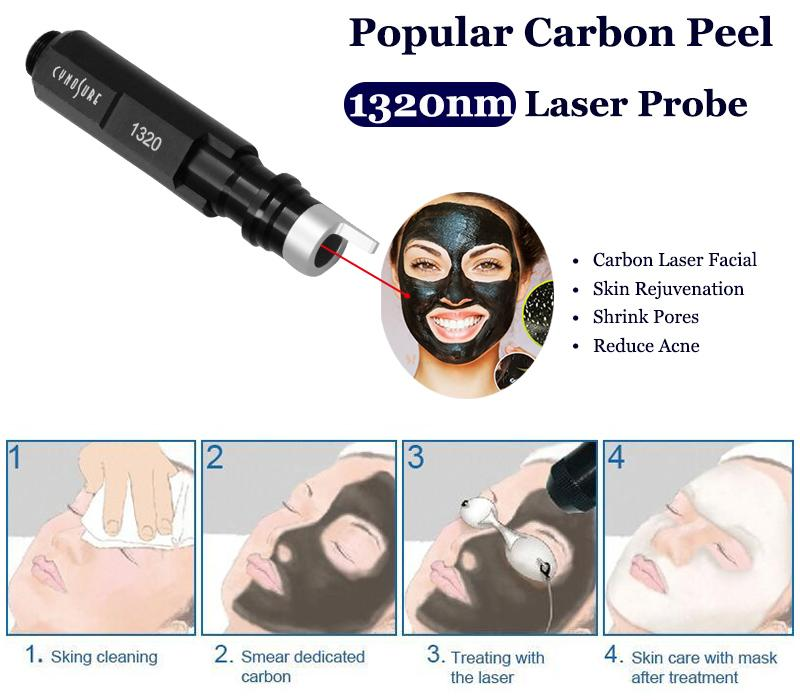 Laser V