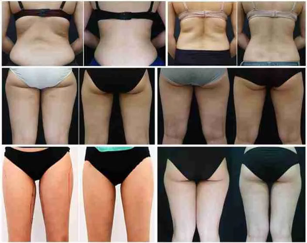 before-after-2
