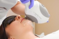 IPL Permanent Hair Removal Post-Treatment Care and Maintenance