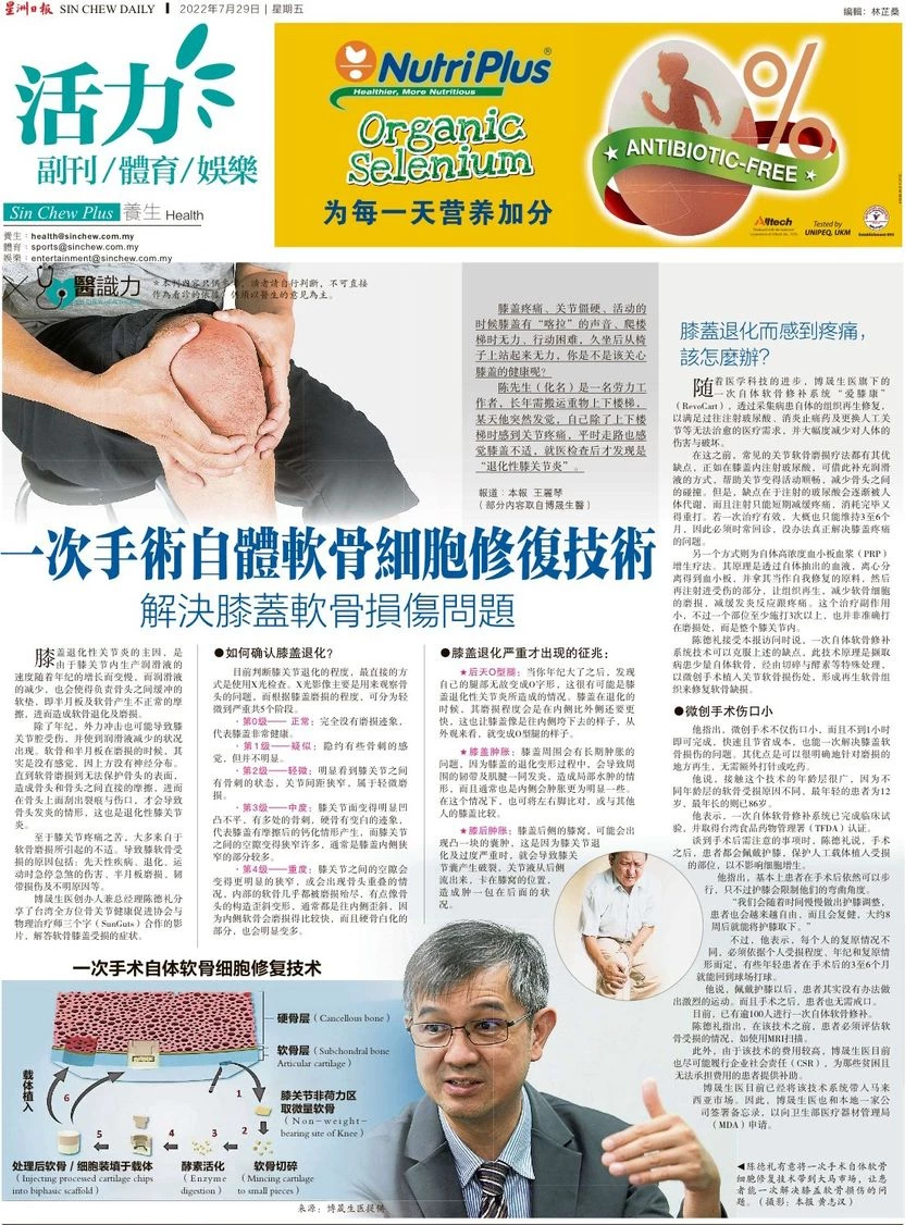 馬來西亞最大報-星洲日報報導博晟愛膝康「一次性自體軟骨細胞修復」技術