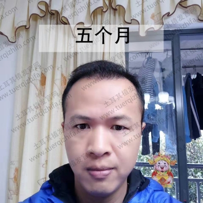 53