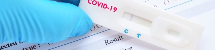 COVID19_rapid_test-scaled-e1585660917266