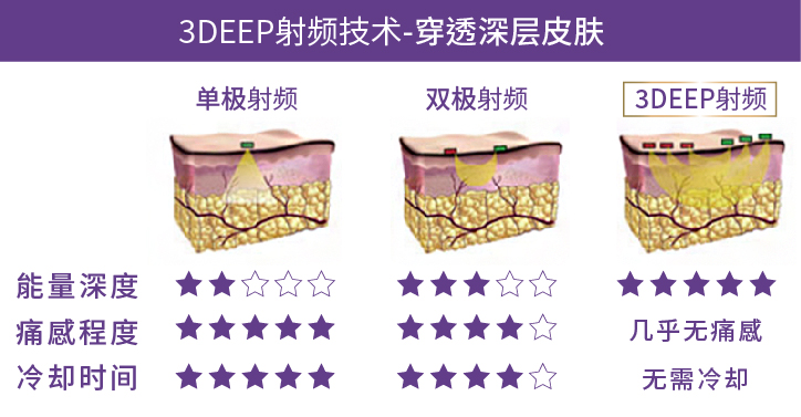 射频黄金微针 射频黄金微针