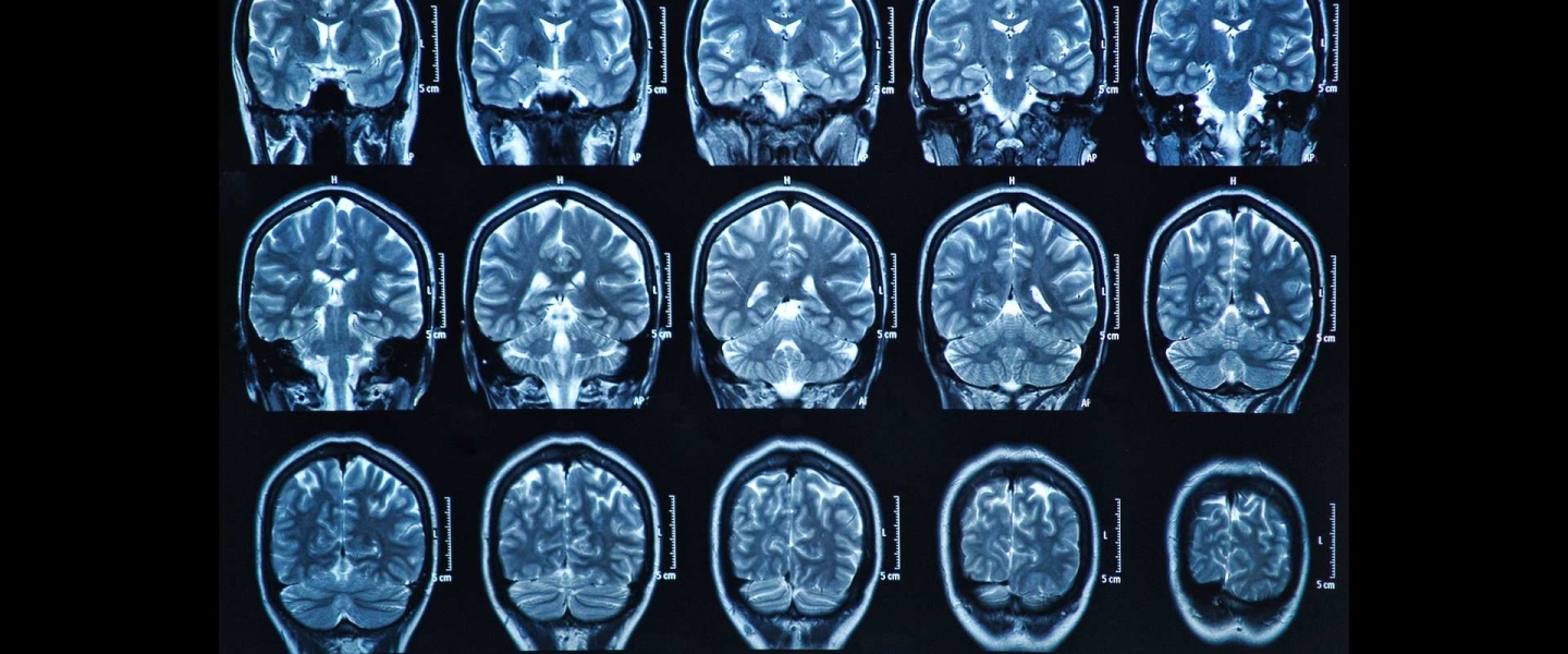 1.解決痛點(diǎn)