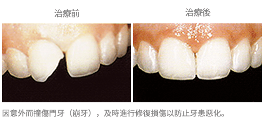 案例1