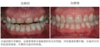 修復案例01
