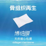 211a69af0b0b34f08da0f5762356000c