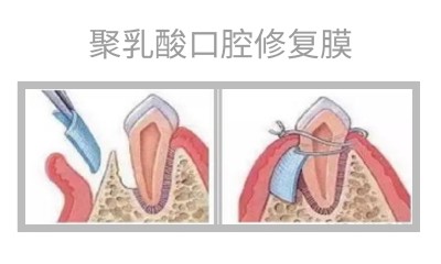 產(chǎn)品應(yīng)用2