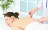 A woman is receiving acupuncture.