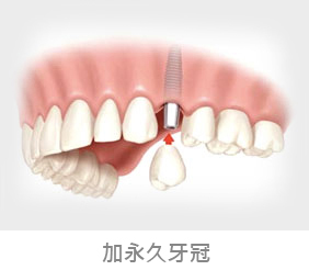 step3