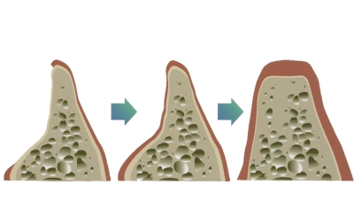 teeth